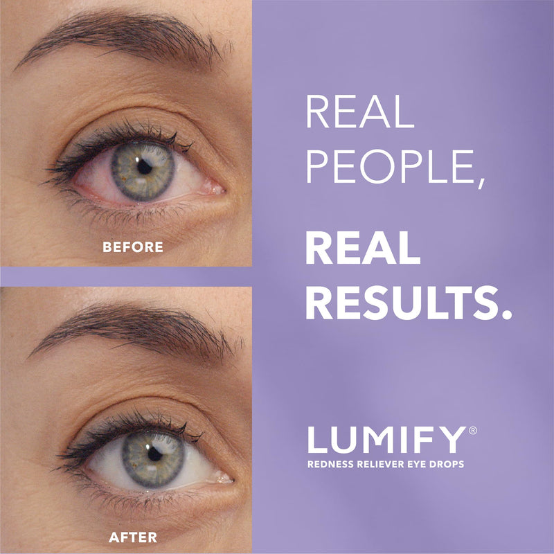 LUMIFY eye drops for red eyes, red redness relief, showing a small 0.17 fl oz bottle with clear liquid in a dropper bottle